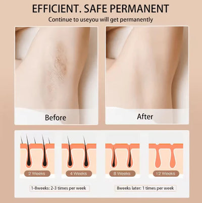 Babyverse - Digital IPL Hair Removal Device ©